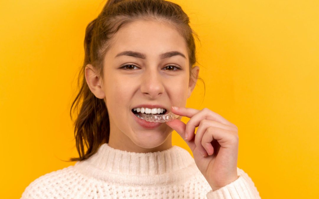 Clear Invisalign aligner used to straighten teeth as an alternative to braces in McKinney, TX