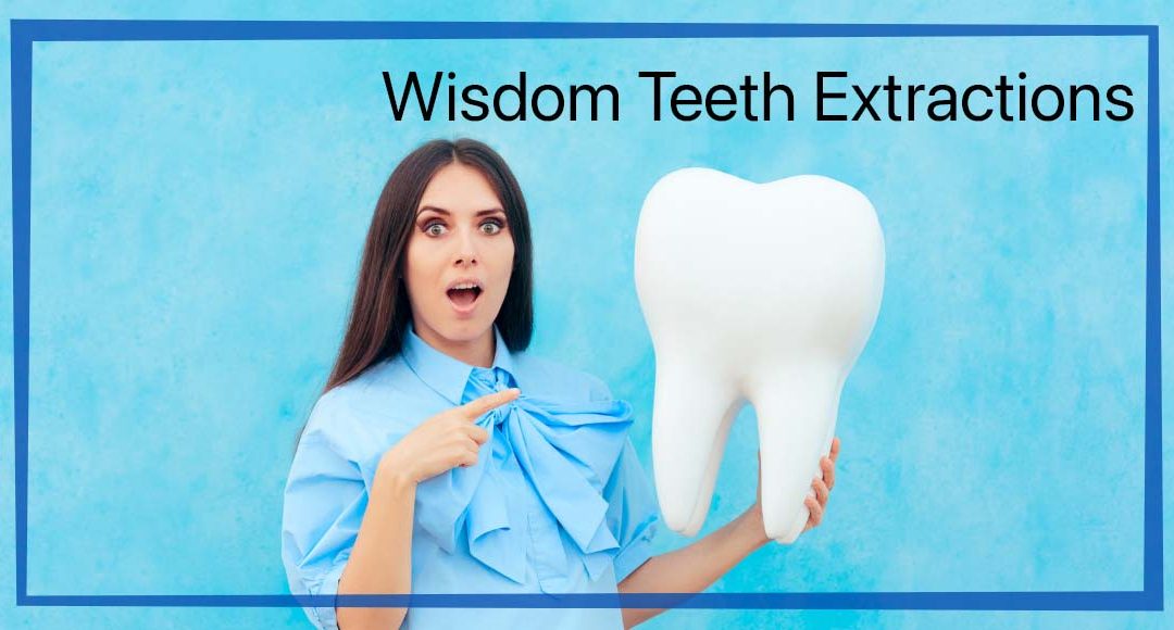 Wisdom teeth removal graphic featuring a large tooth model for dental patients in McKinney, TX